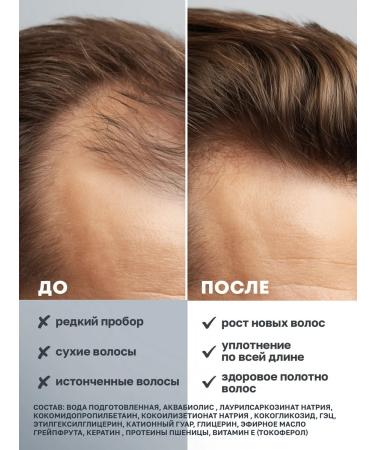 Aquabiolis Salosulfant shampoo from hair loss - Buy Online on GoSupps.com