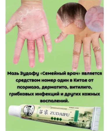 DANA MARKET Chinese ointment from psoriasis - Buy Online on GoSupps.com