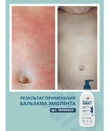 Biolane Lipid -based balm cleansing oil for bathing - Buy Online on GoSupps.com