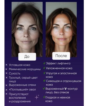 ALLOVEALLURE A membrane mask to restore the skin at the cellular level - Buy Online on GoSupps.com