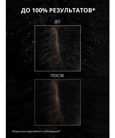 Bioxcin Professional hair shampoo against strong dandruff - Buy Online on GoSupps.com