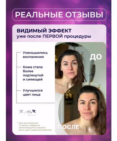 The Mag cosmetics Carboxitherapy face and neck mask - Buy Online on GoSupps.com