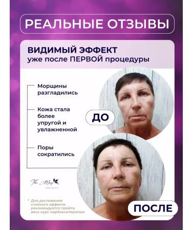 The Mag cosmetics Carboxitherapy face and neck mask - Buy Online on GoSupps.com