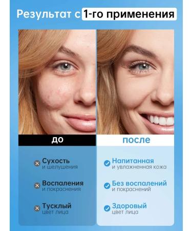 VGO Moisturizing cream with mucin snails 92% for the face 50 g - Buy Online on GoSupps.com