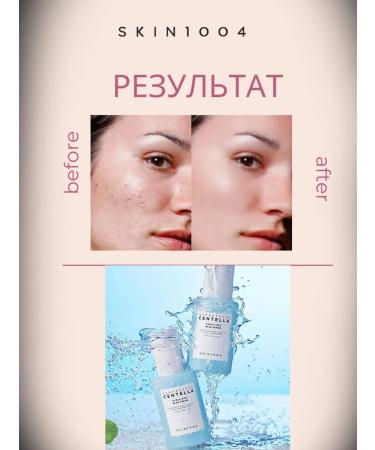 SKIN1004 Moisturizer to the face with centella extract - Buy Online on GoSupps.com