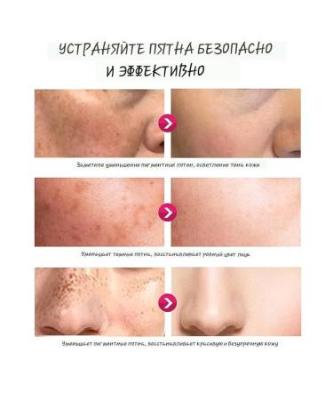 VALLEY Bleaching cream from black spots between the legs of the lobe armpits - Buy Online on GoSupps.com