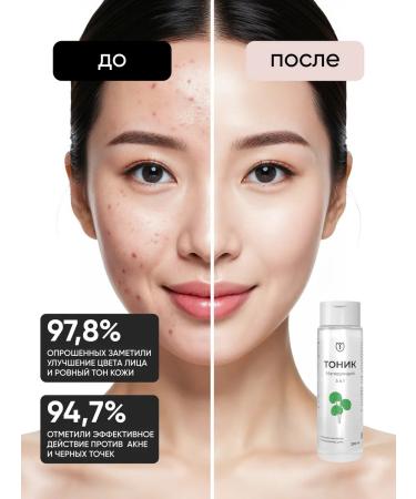 Althea Facial tonic from acne and black dots cleansing - Buy Online on GoSupps.com
