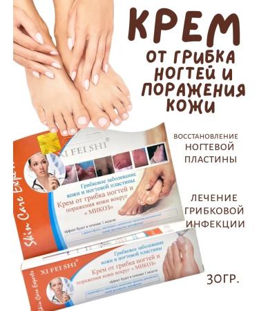 Cinquefoil Remedy for nail fungus on the legs and arms cream