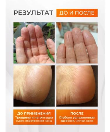 LOVE&JOY Cream wax from cracks for dry skin of the legs and arms - Buy Online on GoSupps.com