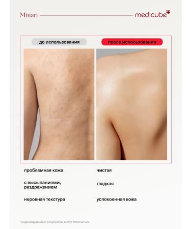 Medicube Shower gel against inflammation on the body - Buy Online on GoSupps.com