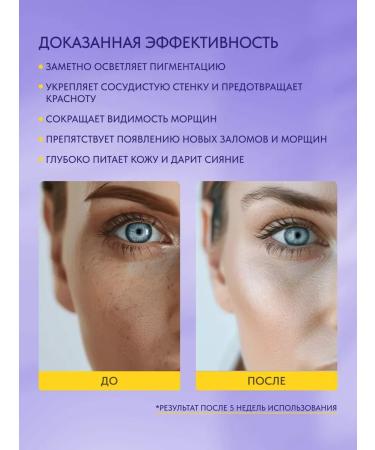 Hidehere Face cream nutriently clarifying against pigmentation - Buy Online on GoSupps.com