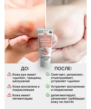 Doctor Bobyr Hand and elbows from dry skin and cracks on the hands - Buy Online on GoSupps.com