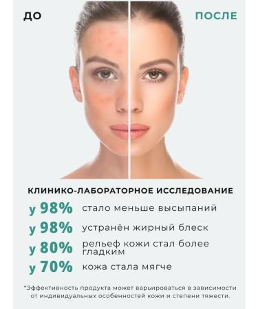 Letique Moisturizing facial set 4V1 - Buy Online on GoSupps.com