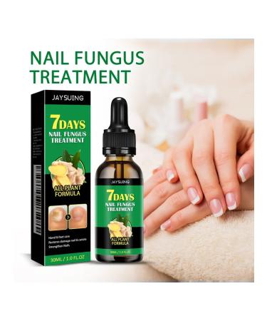 Solution for the treatment of nails with ginger jaysuing