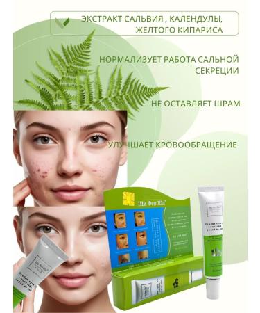 JAMSEA Acne cream - Buy Online on GoSupps.com