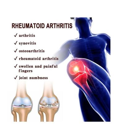 Joint cream (20g from pain and arthritis) - Buy Online on GoSupps.com