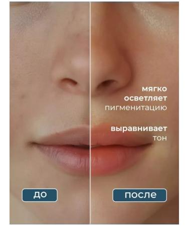 SUNRACTIC COMPLE COMPENT FIRST FIRST 50 SPF - Buy Online on GoSupps.com