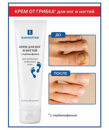 NANO-HEELS Fleet fungus cream on the legs from onycholysis thickening