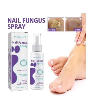 JaySuing nail fungus - Buy Online on GoSupps.com