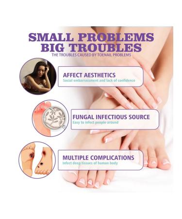 JaySuing nail fungus - Buy Online on GoSupps.com