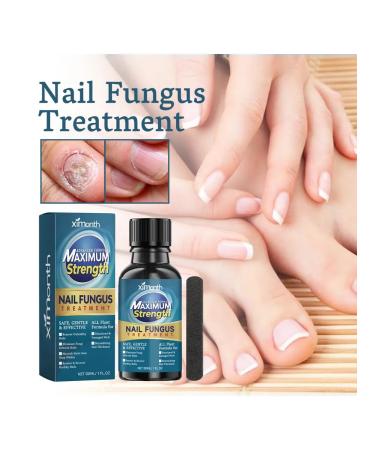 Nail repair solution XIMONTH