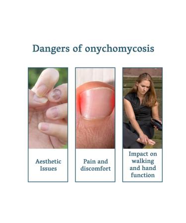 Nail repair solution XIMONTH - Buy Online on GoSupps.com