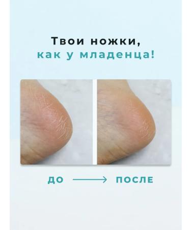 Derma:B Dermma b lamellar cream for legs - Buy Online on GoSupps.com