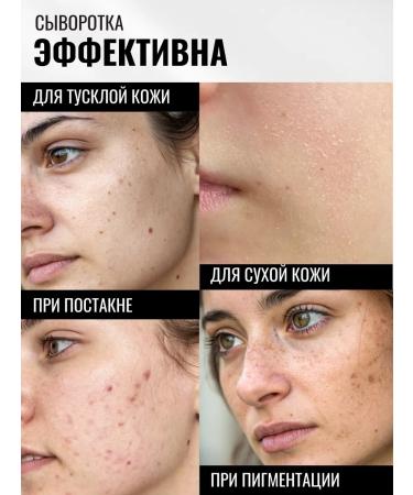 SKIN1004 Facial serum brightening with centella extract - Buy Online on GoSupps.com