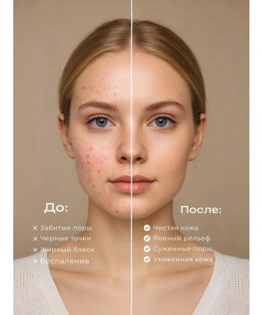 Durin Enzyme powder -peeling 4V1 - Against acne - Buy Online on GoSupps.com