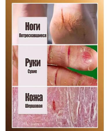 Moisturizing hand cream with dry protection - Buy Online on GoSupps.com