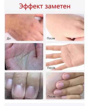 Moisturizing hand cream with dry protection - Buy Online on GoSupps.com