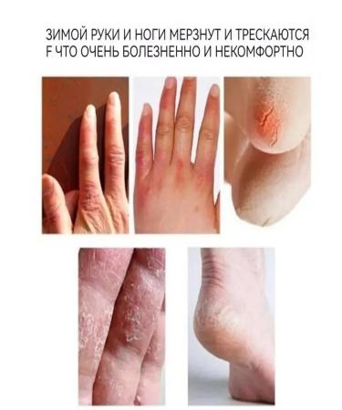 Moisturizing hand cream with dry protection - Buy Online on GoSupps.com