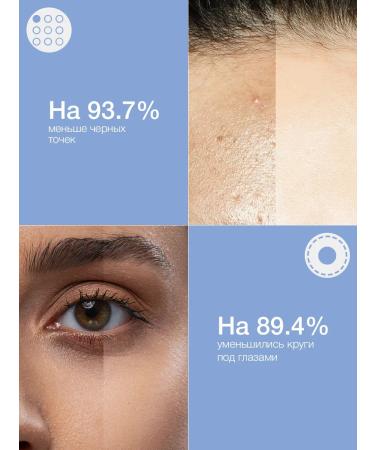 VIS MEDICUS PHARM Wrinkles cream acne and black dots - Buy Online on GoSupps.com