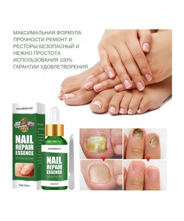 Antifungal - Buy Online on GoSupps.com