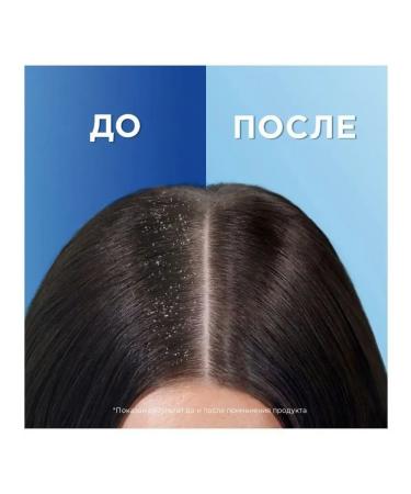 Head & Shoulders Citrus freshness shampoo against dandruff 200 ml 2 pcs - Buy Online on GoSupps.com