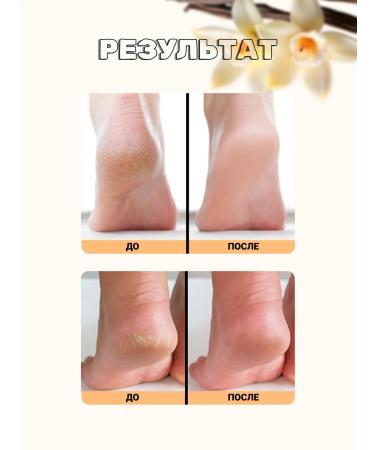 Pumza for the legs and heels with a grater handle - Buy Online on GoSupps.com