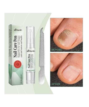 Handle for the treatment of nail fungus XIMONTH - Buy Online on GoSupps.com