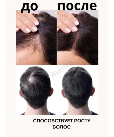 AumRa Kuntalakanti Tainam 200ml Kuntalakanti Oil for Hair Growth - Buy Online on GoSupps.com