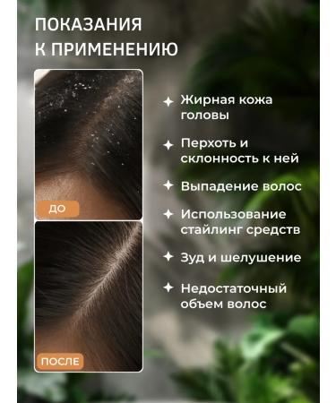 GreenHairLab Piling for scalp professional - Buy Online on GoSupps.com