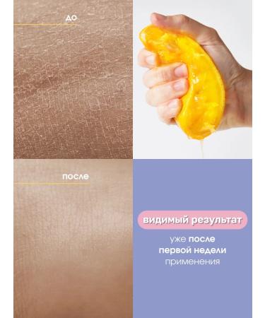 Matsesta Moisturizer with urea for hand - Buy Online on GoSupps.com