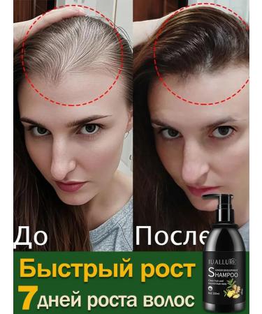 LYDIMOON Shampoo against falling out with ginger extract
