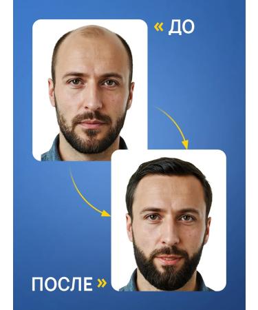 Activator 5% with Mesoroller analogue minnoille - Buy Online on GoSupps.com