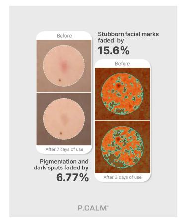 PCALM Night Mask with Exosomas Cicolaacto Exosome - Buy Online on GoSupps.com