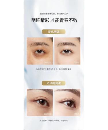 Korea original Anti -aging cream for the area around the eyes - Buy Online on GoSupps.com