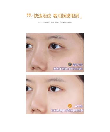 Korea original Anti -aging cream for the area around the eyes - Buy Online on GoSupps.com