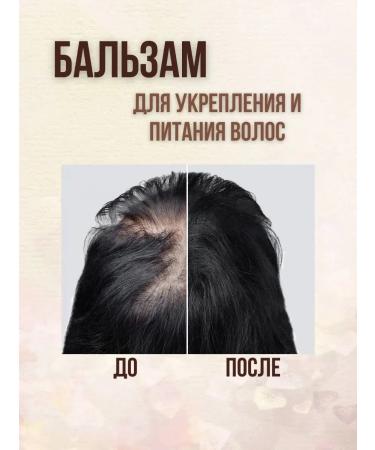 911 + Your emergency service Onion balm from hair loss and baldness 150ml - Buy Online on GoSupps.com