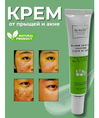 ShaStyle1 Acne cream