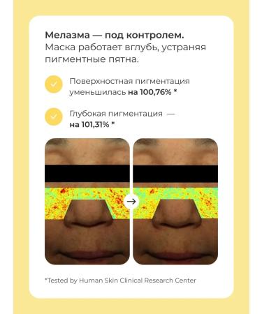 BIODANCE Hydrogel mask Radiant Vita Niacinamide Mask (1 piece) - Buy Online on GoSupps.com