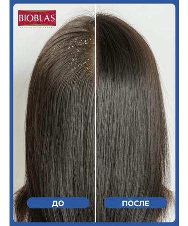 BIOBLAS Shampoo from dandruff and falling with zinc and menthol - Buy Online on GoSupps.com