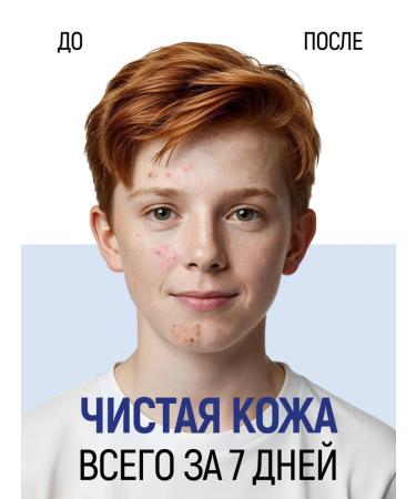 SIBERINA Facial cream of adolescents from acne - Buy Online on GoSupps.com